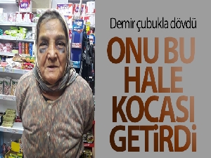 Demir çubukla dövdüğü 73 yaşındaki eşini, bakın ne hale soktu