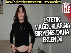 'Estetik mağduru' kadın, profesör hakkında suç duyurusunda bulundu