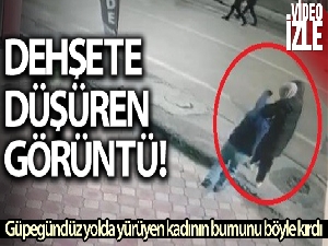 Güpegündüz yolda yürüyen kadının burnunu böyle kırdı