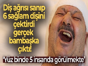 Diş ağrısı sanıp 6 sağlam dişini çektirdi, meğer gerçek bambaşka çıktı