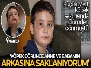 Köpek saldırısında ölümden dönen Mert: 'Köpek görünce anne ve babamın arkasına saklanıyorum'