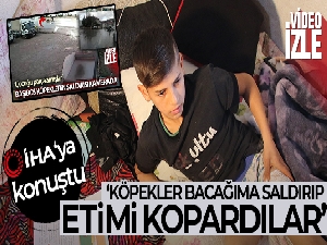 Köpek saldırısına uğrayan çocuk İHA'ya konuştu