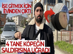 İşe gitmek için evinden çıktı, 4 tane köpeğin saldırısına uğradı