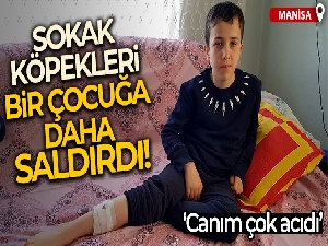 Sokak köpekleri bir çocuğa daha saldırdı