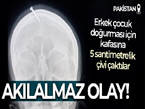 Pakistan'da erkek çocuk doğurmak için hamile kadının kafasına 5 santimetrelik çivi çaktılar