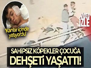 Edirne'de köpekler çocuğa dehşeti yaşattı: O anlar kamerada