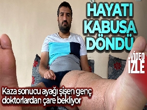 5 yıl önce tekstil fabrikasında kaza geçiren gencin ayağının şişmesiyle hayatı kabusa döndü