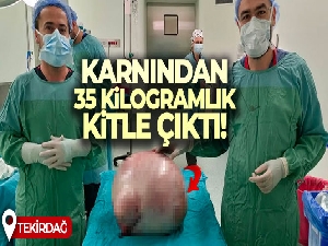 Karnından 35 kilogramlık kitle çıktı