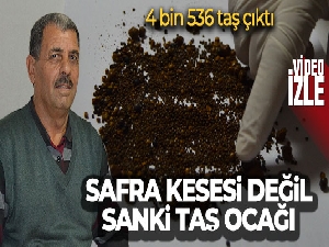 Safra kesesi değil sanki taş ocağı: 4 bin 536 taş çıktı