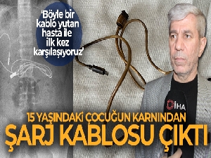Çocuğun karnından çıkan kablo profesörü bile şaşırttı