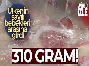 Tekirdağ'da 310 gramlık bebek doğdu