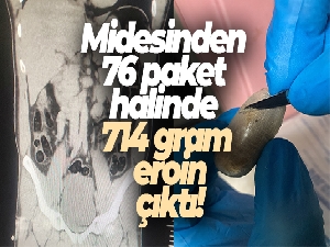 Batman'da bir kişinin midesinden 714 gram eroin ele geçirildi