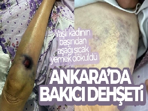 Ankara'da bakıcı dehşeti: 91 yaşındaki yaşlı kadın hastanede ölüm kalım savaşı veriyor