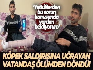 Komşusunun köpeğinin saldırısına uğrayan vatandaşın parmağı koptu, eli parçalandı