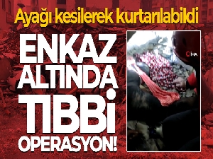 Enkaz altında tıbbi operasyon! Ayağı kesilerek kurtarılabildi