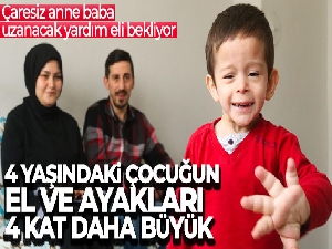 4 yaşındaki çocuğun el ve ayakları olması gerekenden 4 kat daha büyük