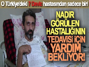 O Türkiye'deki 7 Devic hastasından sadece biri