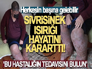 Sivrisinek, güvenlik görevlisinin hayatını kararttı