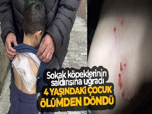 Sokak köpeklerinin saldırdığı 4 yaşındaki çocuk ölümden döndü
