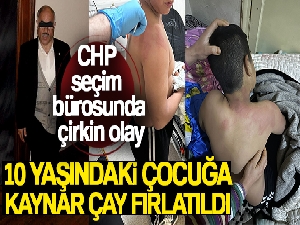 Seçim bürosunda çirkin olay... CHP seçim bürosunda 10 yaşındaki çocuğa kaynar çay fırlatıldı