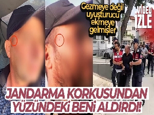 Jandarma korkusundan yüzündeki beni aldırdı
