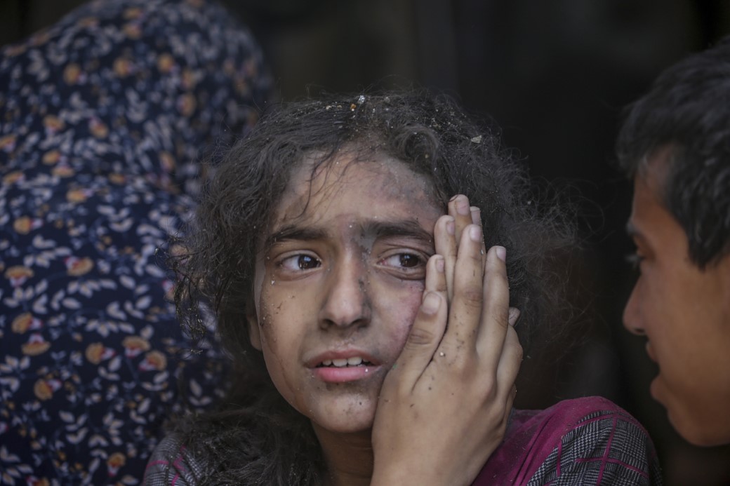 Gazze’de can kaybı 34 bin 683’e yükseldi