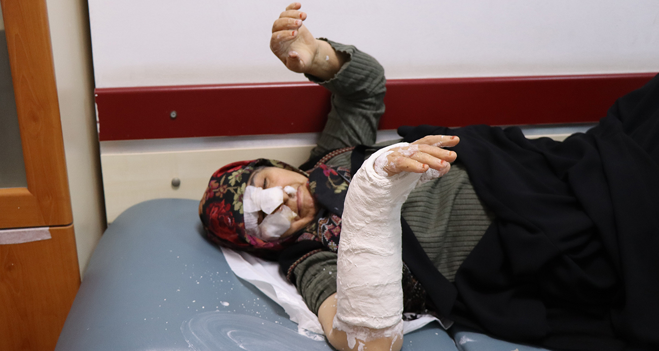 Erzurum Oltu’da sokak köpekleri dehşet saçtı