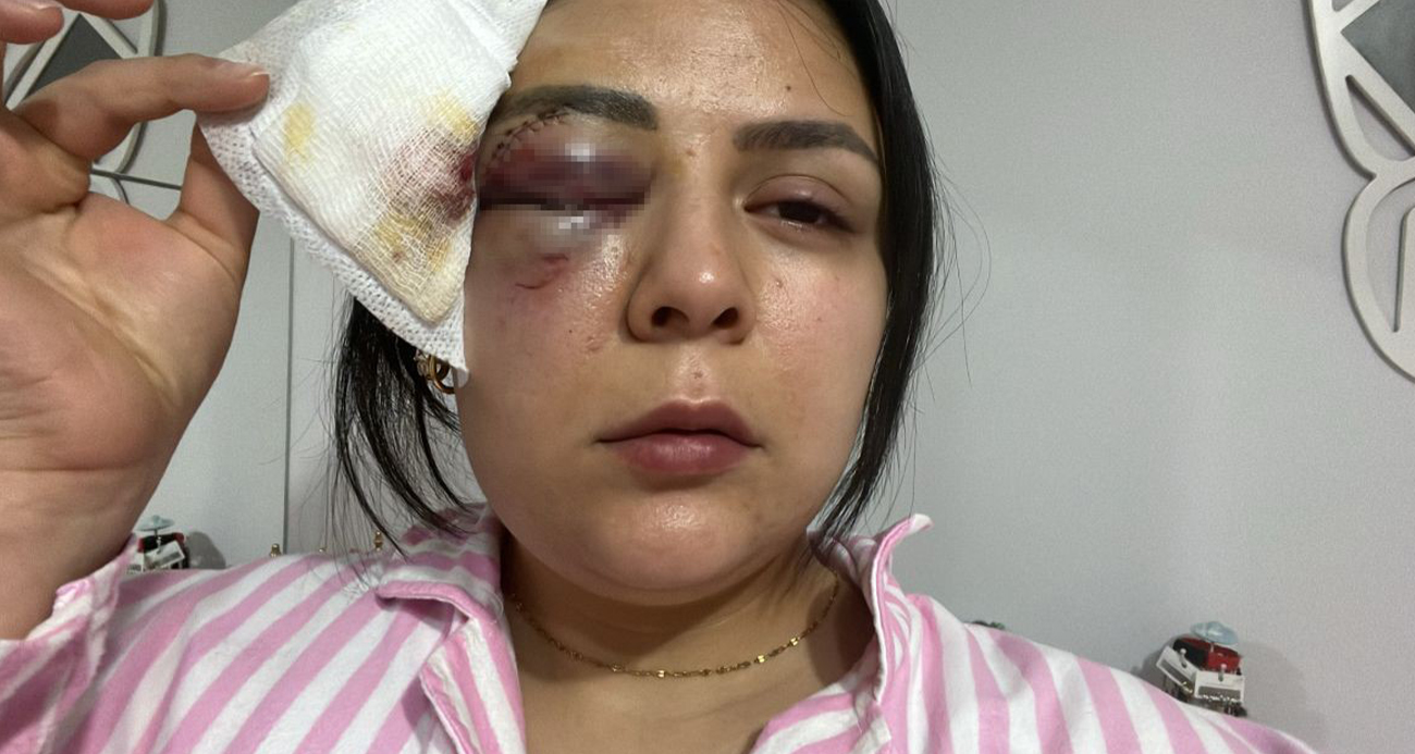 Yürürken saldırıya uğrayan genç kız konuştu: 