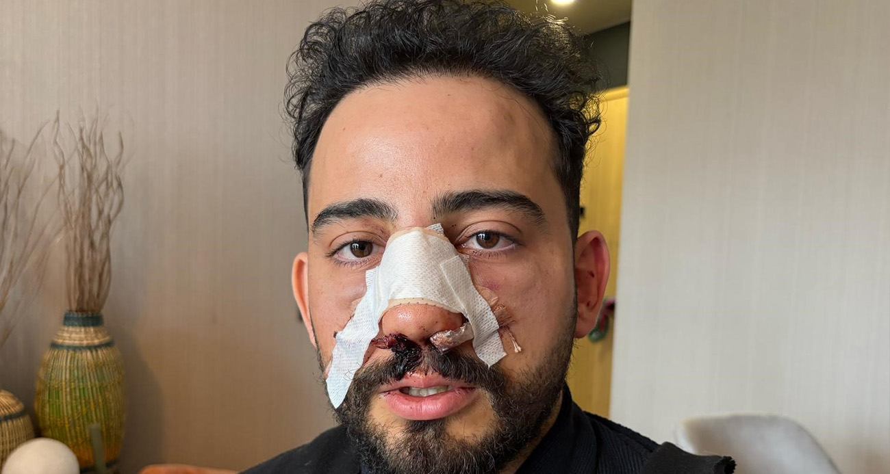 Siparişler geciktiği için gitmek isteyen müşteriye restoran çalışanlarından öldüresiye darp