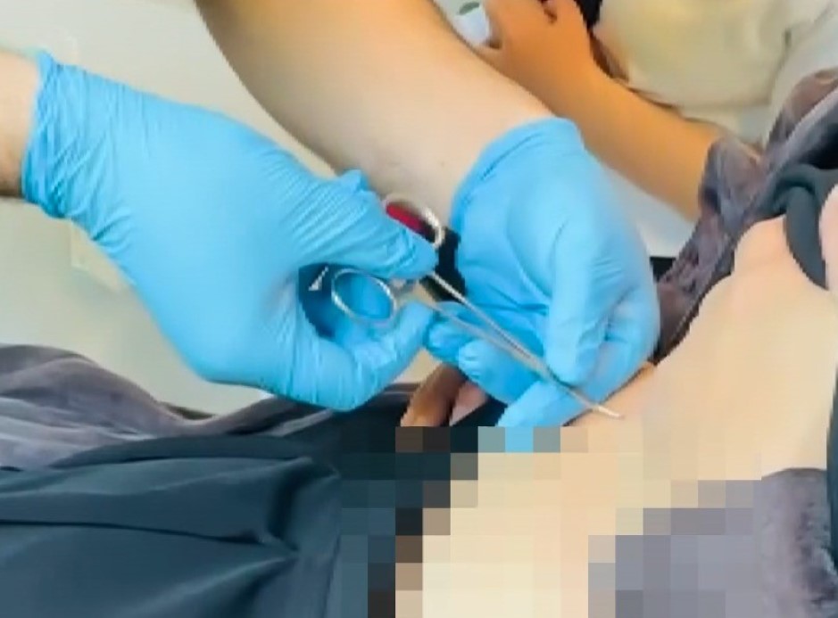 Hastaneye gitti, karnına yapışan kene ile karşılaştı