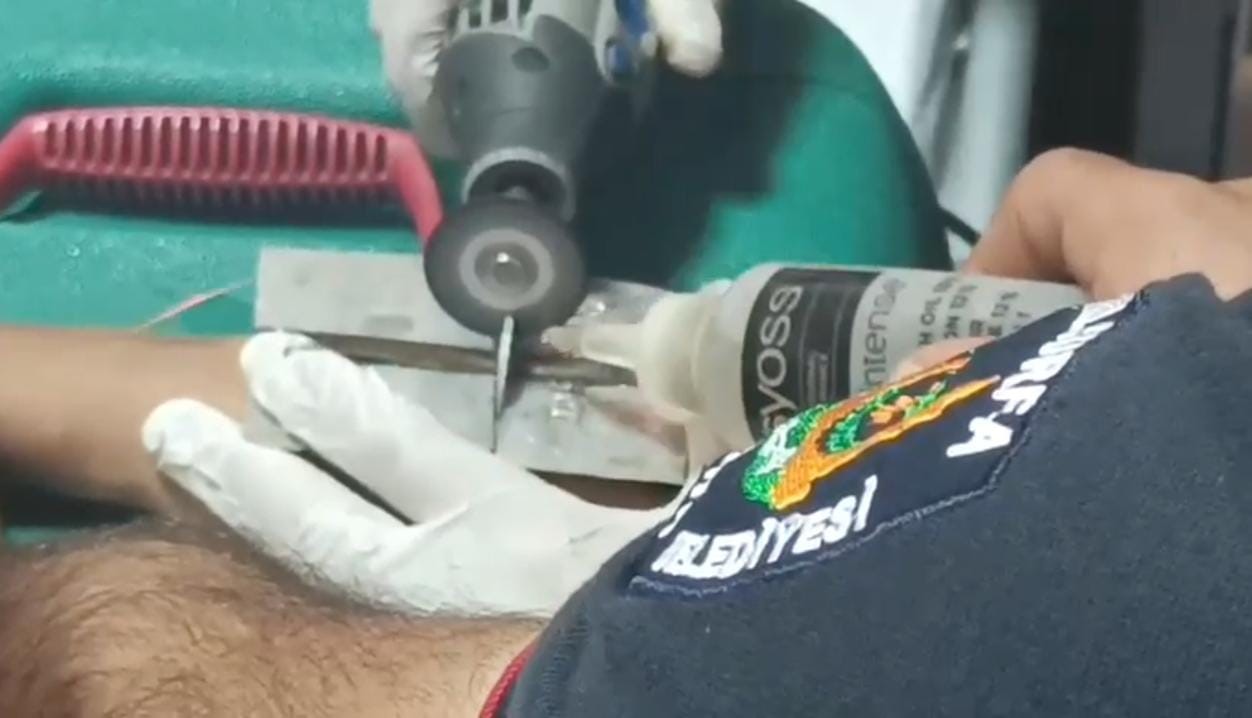 Çocuğun parmağına sıkıştırdığı cıvata pulu kesilerek çıkartıldı