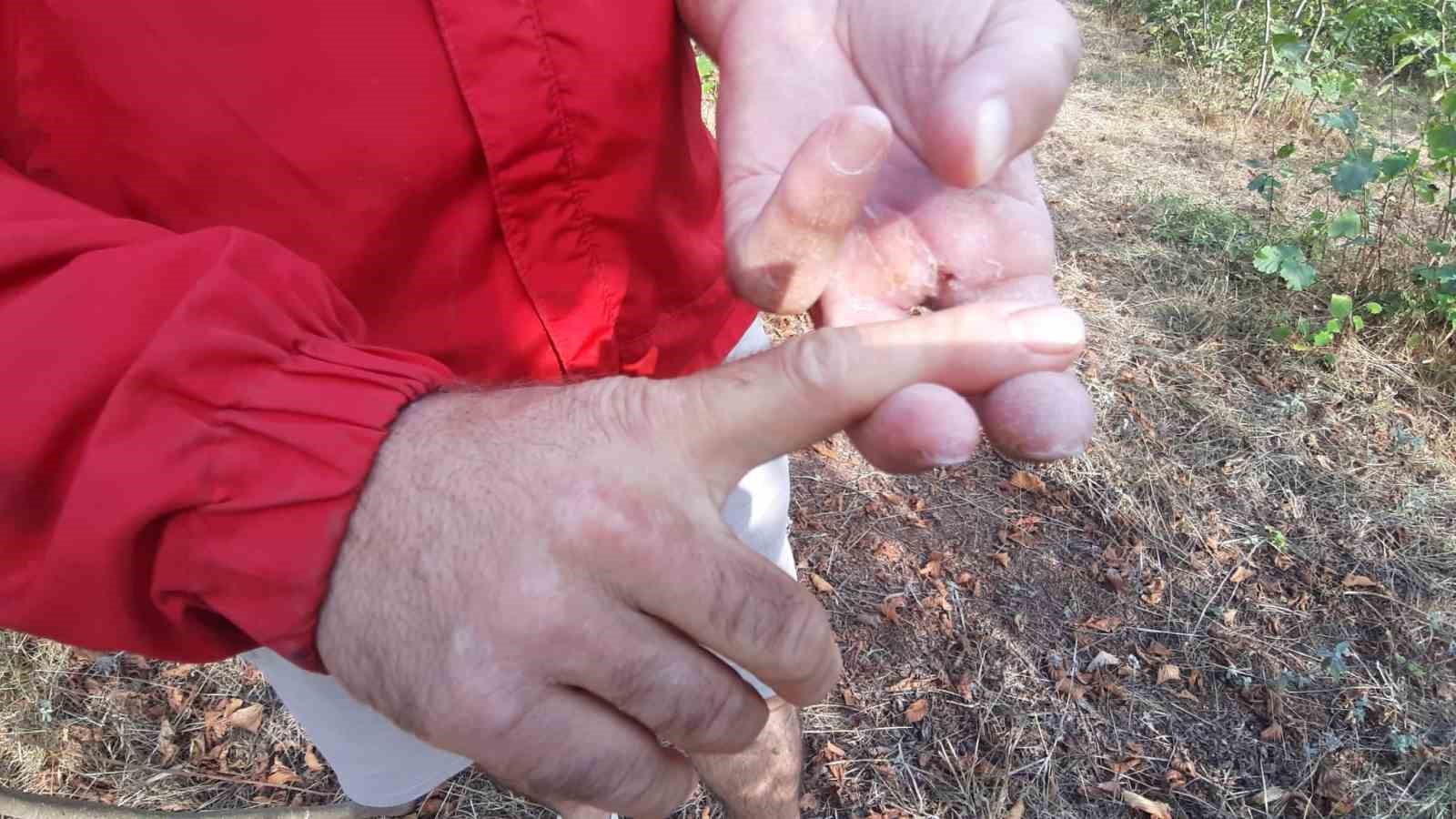 Ayının saldırısına uğrayan çiftçi dehşet anlarını anlattı: 