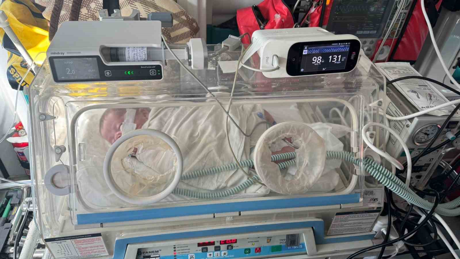 Kerem bebek, hava yolu ile Karabük’e sevk edilerek tedavi altına alındı