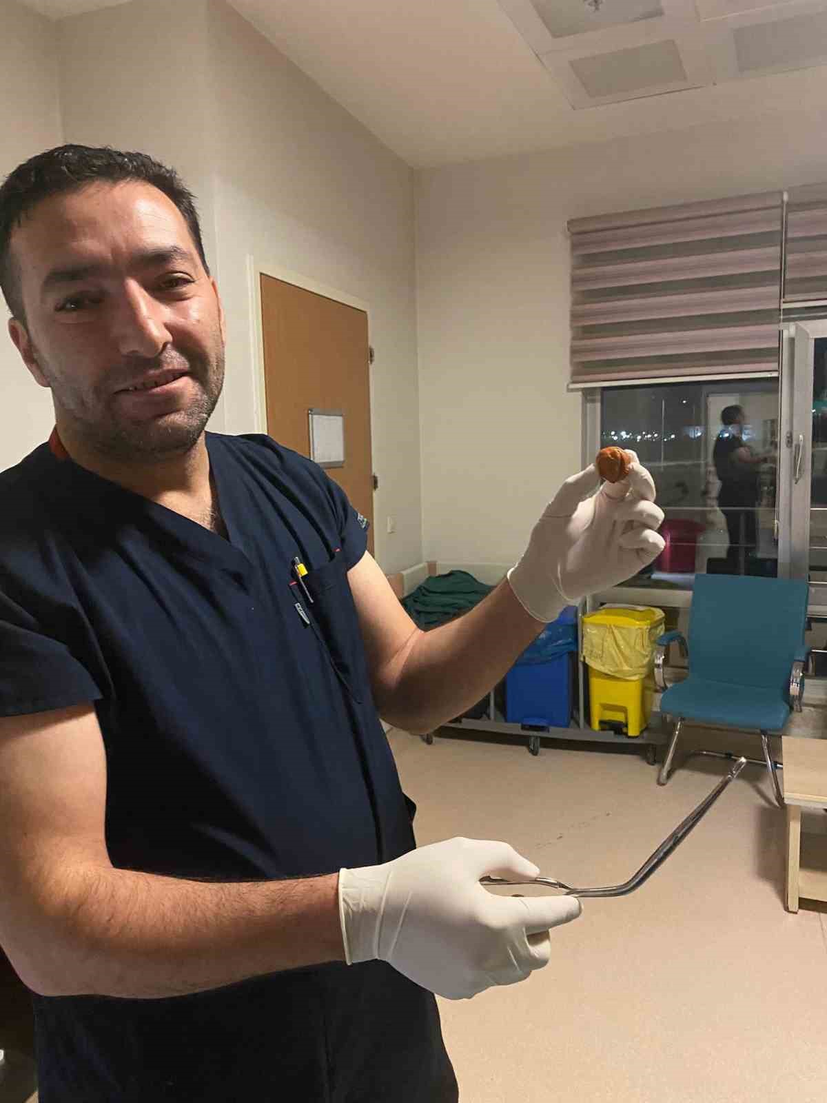 Ağrı’da yuttuğu ceviz yemek borusundan çıkarıldı