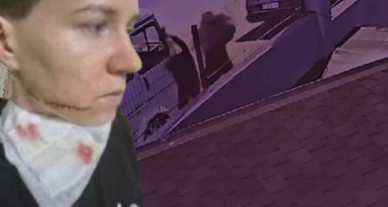 Saldırıya uğrayan Ukraynalı kadının kimliği belli oldu, yüzündeki derin çizik dikkat çekti