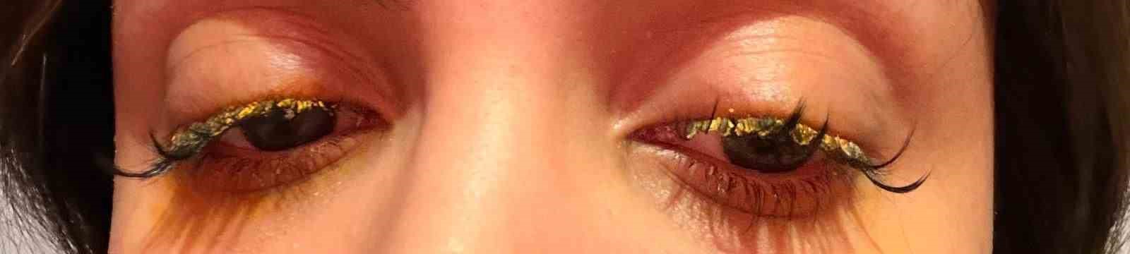 Güzellik merkezinde genç kadının gözüne yapıştırıcı kaçtı: 