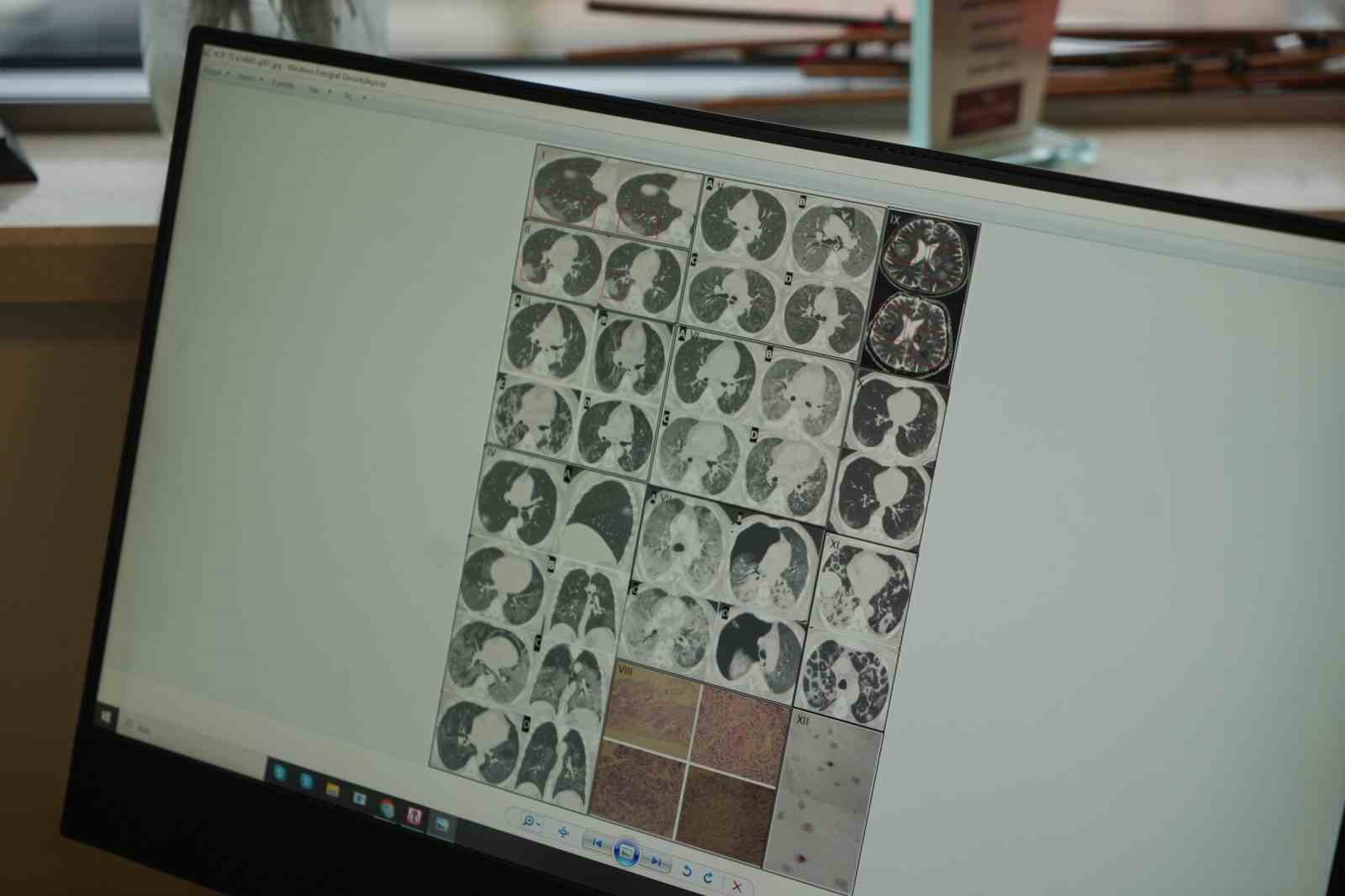 Gençlerde ani ölümler artıyor: 