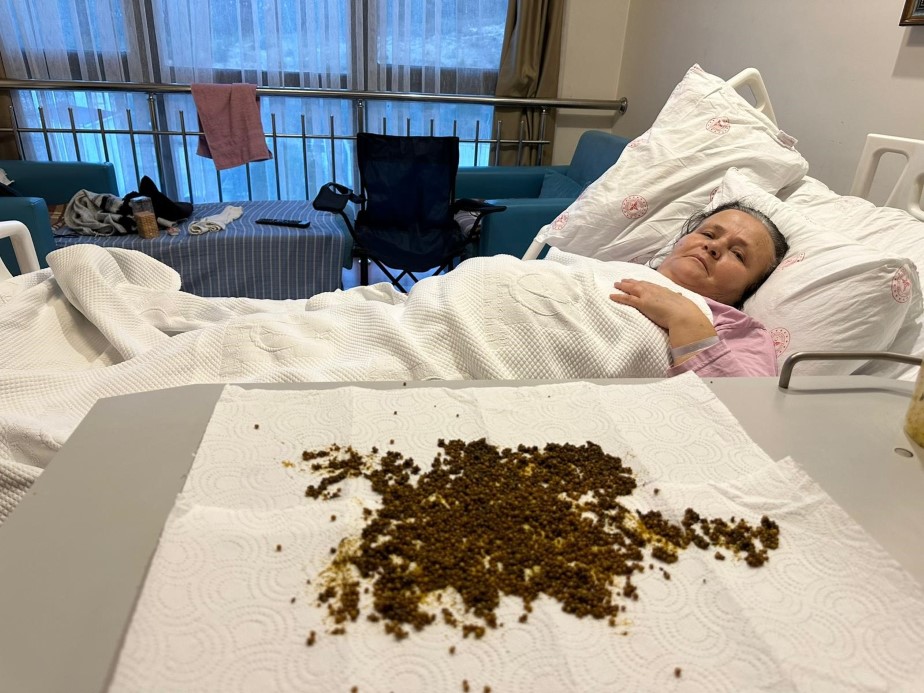 Hastadan çıkan taşları sayamadılar