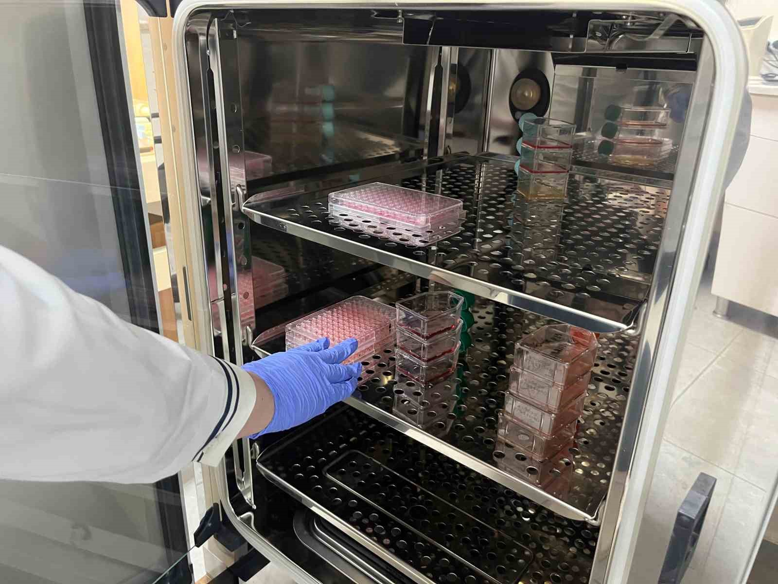 Parkinson’da bağırsak- beyin iletişimi çip üstü organ teknolojisiyle araştırılıyor