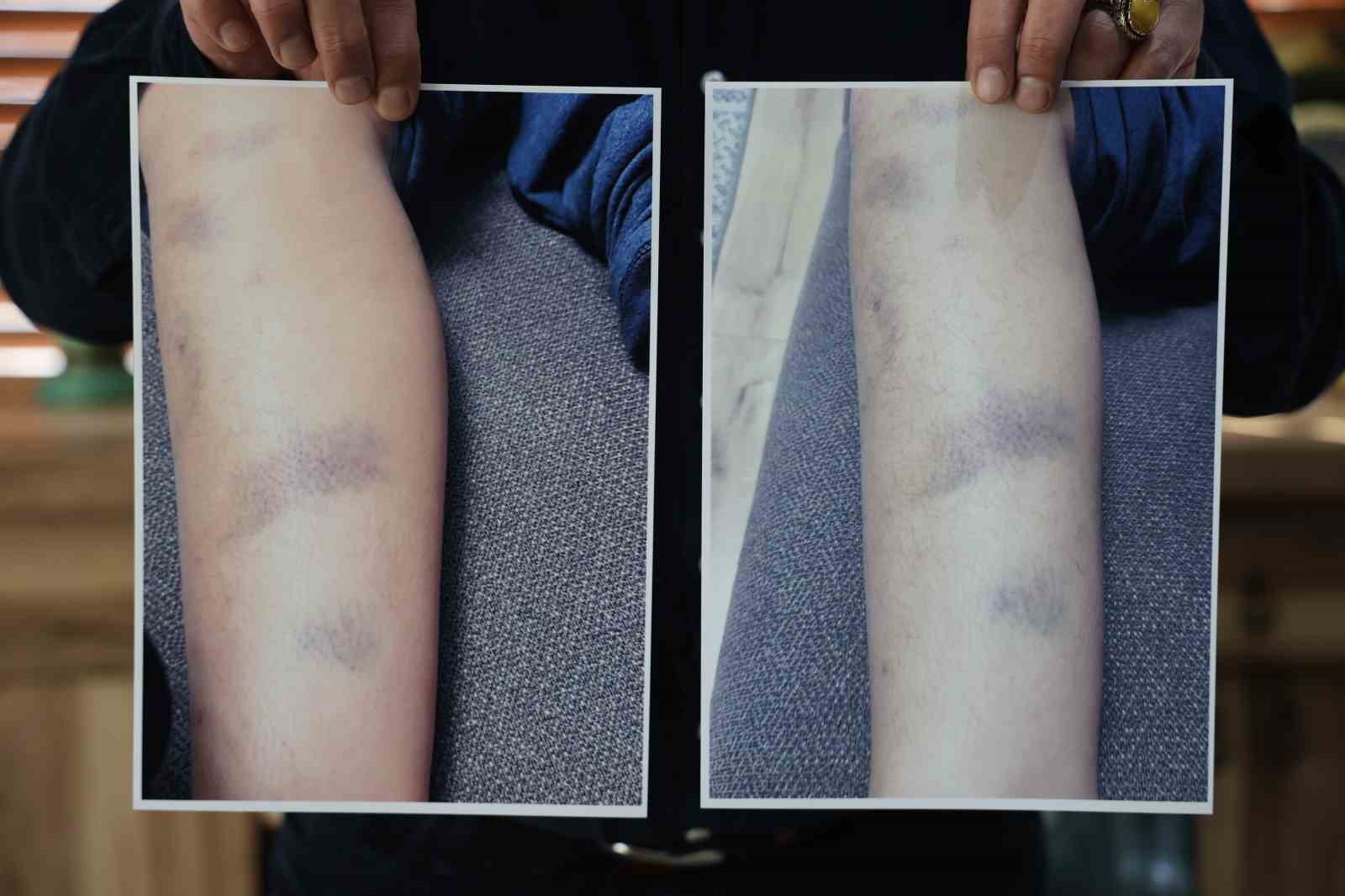 Diyarbakır’da özel okulda 8 yaşındaki çocuğun darbedildiği iddiası