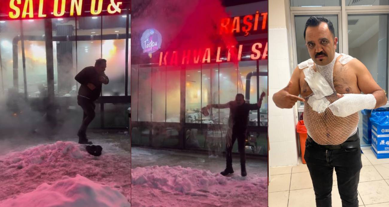 Meşhur tostçu, soğuk havada şov yapmak isterken kendini yaktı