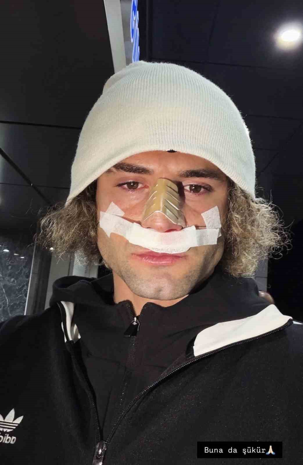 Elazığspor’da Fuat Bavuk’un burnu kırıldı