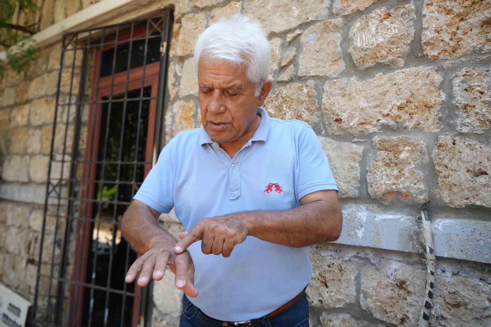 su-altinda-temizlik-yaparken-eline-aslan-baligi-dikenleri-batan-profesorden-sicak-sulu-ilk-mudahale-uyarisi