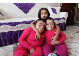 Cam Kemik Hastası İkizlerden Birinin Kemiği Kırılınca Diğeri De Hissediyor