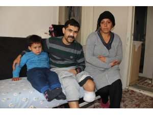 Yaşarken Çürümeye Başladı