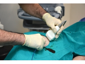 Variste Ameliyatsız Tedavi Dönemi