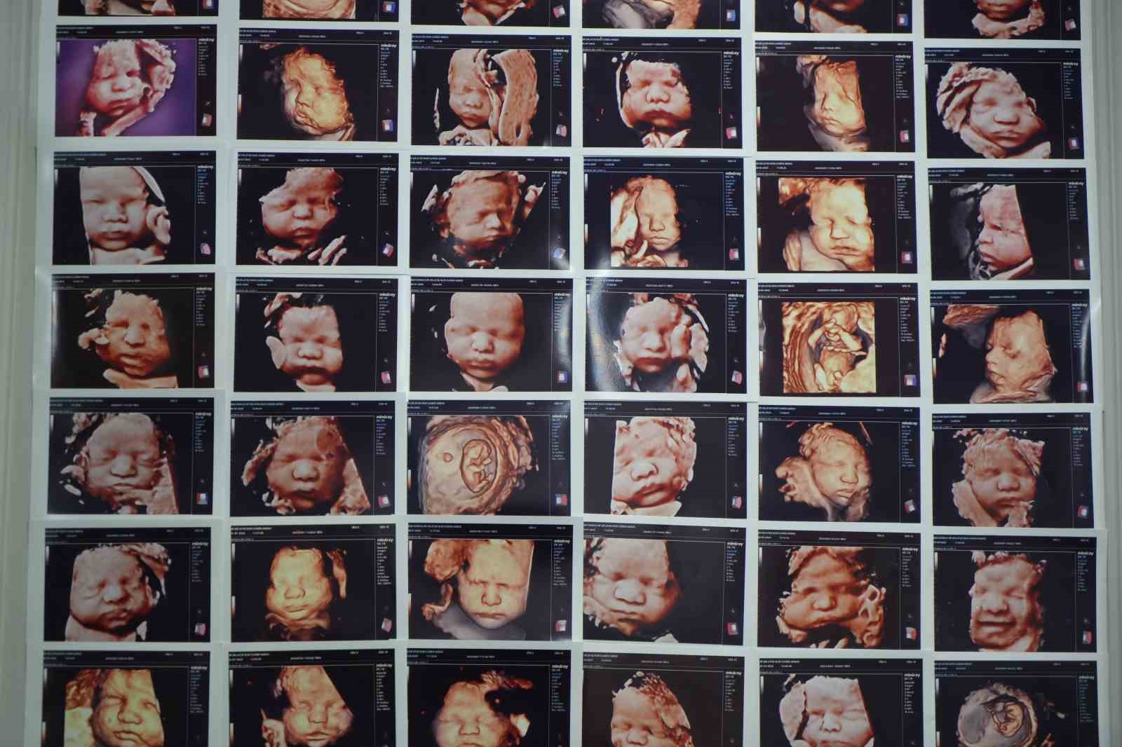 7-yillik-bebek-hasreti-kisiye-ozel-tedaviyle-son-buldu