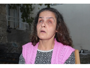 Bir Taşla Dünyası Karardı