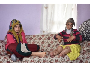 Elleri Ve Kolları Her Geçen Gün Eriyor