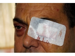 Yüzde 90 Görme Engeli Bulunan Şahıs Emeklilik Bekliyor